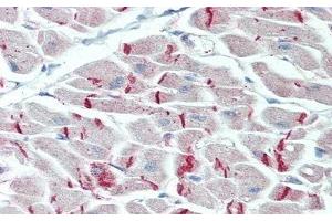 Detection of DSP in Human Heart Tissue using Polyclonal Antibody to Desmoplakin (DSP) (Desmoplakin anticorps  (AA 2609-2822))