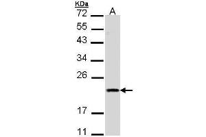 WB Image Sample (30 ug of whole cell lysate) A: A431 , 12% SDS PAGE antibody diluted at 1:1000 (DIABLO anticorps)