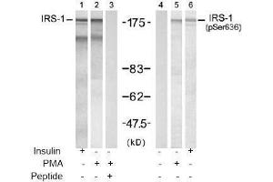 Image no. 2 for anti-Insulin Receptor Substrate 1 (IRS1) (pSer636) antibody (ABIN196978) (IRS1 anticorps  (pSer636))
