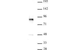 PKC-B antibody (pAb) tested by Western blot. (PKC beta anticorps  (C-Term))
