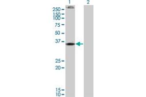 Western Blot analysis of CNR2 expression in transfected 293T cell line by CNR2 monoclonal antibody (M01), clone 3C7. (CNR2 anticorps  (AA 302-360))