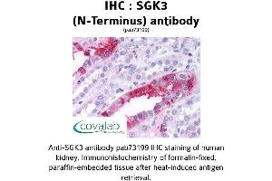 Image no. 1 for anti-serum/glucocorticoid Regulated Kinase Family, Member 3 (SGK3) (N-Term) antibody (ABIN1739229)