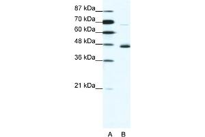 WB Suggested Anti-NEUROD1 Antibody Titration:  1. (NEUROD1 anticorps  (N-Term))