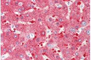 Human Liver: Formalin-Fixed, Paraffin-Embedded (FFPE) (ALDH1L1 anticorps  (AA 402-902))