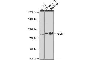 Western blot analysis of extracts of various cell lines using KIF2B Polyclonal Antibody at dilution of 1:1000. (KIF2B anticorps)