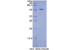 SDS-PAGE analysis of Human Plasminogen Protein.