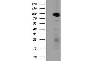Western Blotting (WB) image for anti-Protein Kinase D2 (PKD2) antibody (ABIN1500410) (PKD2 anticorps)