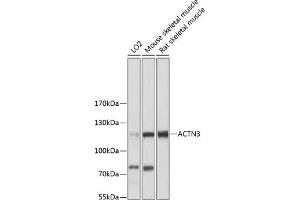 Western blot analysis of extracts of various cell lines, using  antibody  at 1:3000 dilution. (ACTN3 anticorps  (AA 580-630))