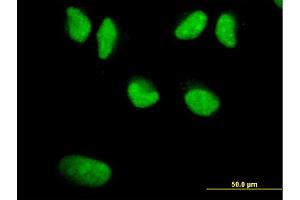 Immunofluorescence of monoclonal antibody to WRN on HeLa cell.