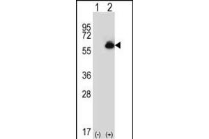 Western blot analysis of ALDH4A1 (arrow) using rabbit polyclonal ALDH4A1 Antibody (C-term) (ABIN392356 and ABIN2841995). (ALDH4A1 anticorps  (C-Term))