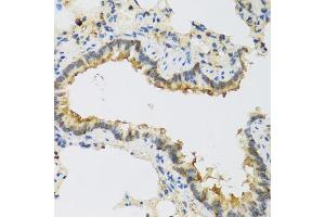 Immunohistochemistry of paraffin-embedded rat lung using FAM20A antibody (ABIN5974869) at dilution of 1/100 (40x lens). (FAM20A anticorps)