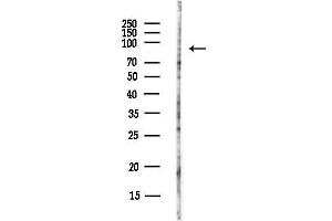 anti-Ring Finger Protein 43 (RNF43) antibody