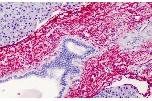 Human Pancreas: Formalin-Fixed, Paraffin-Embedded (FFPE) (Elastin anticorps)