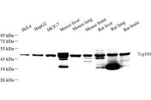 Western blot analysis of Tsg101 (ABIN7076083) at dilution of 1: 500 (TSG101 anticorps  (N-Term))