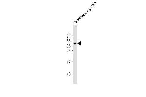 FAT4 recombinant protein at 20 µg per lane, probed with bsm-51360M FAT4 (1654CT645. (FAT4 anticorps)