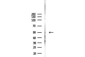 Western blot analysis of lysates from A2780 cells(starvation, 24h treatment), using Phospho-ARRB1 (Ser412) Antibody at 1/1000 dilution.