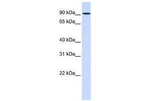 HSPH1 antibody used at 1 ug/ml to detect target protein. (HSPH1 anticorps  (Middle Region))
