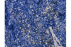 ABIN6266100 and ABIN6278545 at 1/100 staining mouse spleen tissue by IHC-P. (ZNF598 anticorps  (N-Term))