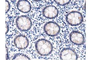 Immunohistochemistry (IHC) image for anti-DnaJ (Hsp40) Homolog, Subfamily A, Member 2 (DNAJA2) antibody (ABIN1497859) (DNAJA2 anticorps)