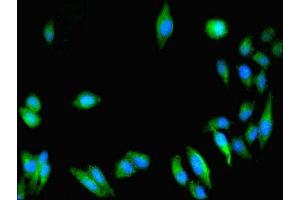 Immunofluorescent analysis of Hela cells using ABIN7154769 at dilution of 1:100 and Alexa Fluor 488-congugated AffiniPure Goat Anti-Rabbit IgG(H+L)