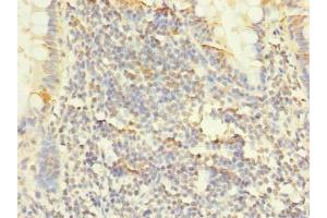 Immunohistochemistry of paraffin-embedded human small intestine tissue using ABIN7163353 at dilution of 1:100