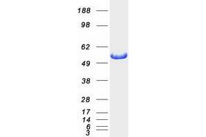 Validation with Western Blot