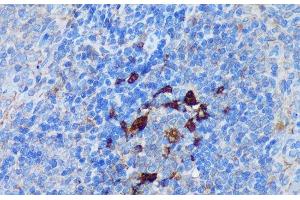 Immunohistochemistry of paraffin-embedded Rat spleen using PADI4 Polyclonal Antibody at dilution of 1:100 (40x lens).