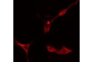 ABIN6275895 staining  Hela cells by IF/ICC. (MCPH1 anticorps  (N-Term))