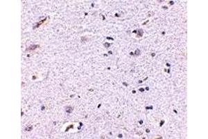 Immunohistochemistry (IHC) image for anti-Syntaphilin (SNPH) (N-Term) antibody (ABIN1031595) (Syntaphilin anticorps  (N-Term))