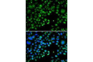 Immunofluorescence analysis of MCF-7 cells using TXNDC5 antibody.
