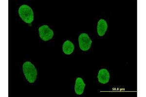 Immunofluorescence of purified MaxPab antibody to SOCS4 on HeLa cell. (SOCS4 anticorps  (AA 1-440))