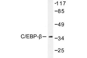 Image no. 1 for anti-CCAAT/enhancer Binding Protein (C/EBP), beta (CEBPB) antibody (ABIN265332) (CEBPB anticorps)