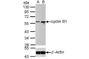 WB Image Western blot analysis of cyclin B1 (, upper panel) and beta-actin , lower panel) Sample (30 ug of whole cell lysate) A: U2OS B: U2OS treated 100ng/ml Nocodazole 16hr 10% SDS PAGE antibody diluted at 1:500 (Cyclin B1 anticorps)