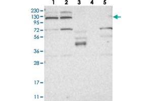Western blot analysis of Lane 1: RT-4, Lane 2: U-251 MG, Lane 3: Human Plasma, Lane 4: Liver, Lane 5: Tonsil with KIF4A polyclonal antibody  at 1:250-1:500 dilution. (KIF4A anticorps)