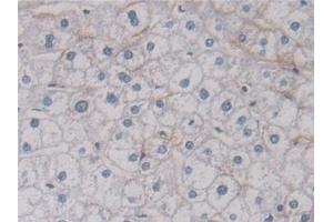 Detection of ANXA11 in Human Liver Tissue using Polyclonal Antibody to Annexin A11 (ANXA11)