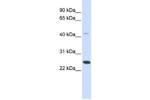 Western Blotting (WB) image for anti-Family With Sequence Similarity 119A (FAM119A) antibody (ABIN2459591) (FAM119A anticorps)