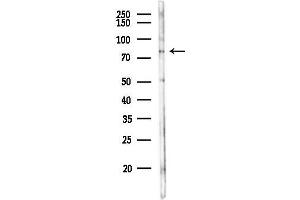 anti-F-Box and Leucine-Rich Repeat Protein 5 (FBXL5) antibody