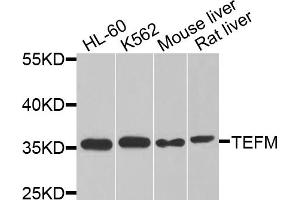 Western blot analysis of extracts of various cell lines, using TEFM antibody.