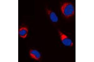 Immunofluorescent analysis of Beta-tubulin staining in Jurkat cells. (TUBB anticorps  (C-Term))