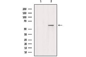 Western blot analysis of extracts from Mouse spleen, using RABEP2 Antibody.