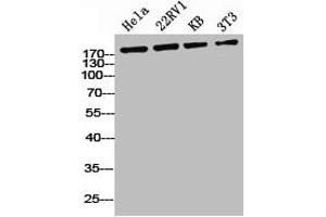 Western Blot analysis of HELA 22RV1 KB NIH-3T3 cells using Phospho-IRS-1 (S636) Polyclonal Antibody (IRS1 anticorps  (pSer636))