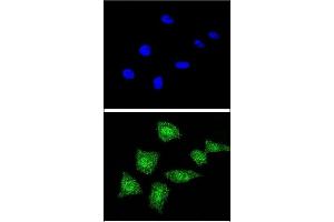 Confocal immunofluorescent analysis of SOD1 Antibody (Center) (ABIN652681 and ABIN2842453) with 293 cell followed by Alexa Fluor® 488-conjugated goat anti-rabbit lgG (green). (SOD1 anticorps  (AA 55-84))