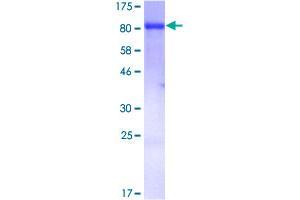 Image no. 1 for Moesin (MSN) (AA 1-577) protein (GST tag) (ABIN1311465)