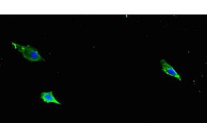 Immunofluorescent analysis of Hela cells using ABIN7177325 at dilution of 1:100 and Alexa Fluor 488-congugated AffiniPure Goat Anti-Rabbit IgG(H+L)