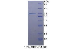 SDS-PAGE analysis of Human Smad5 Protein. (SMAD5 Protéine)