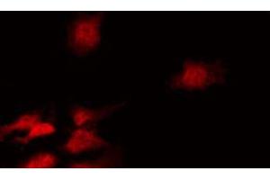 ABIN6267463 staining HeLa by IF/ICC.