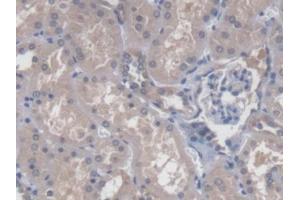 DAB staining on IHC-P; Samples: Human Kidney Tissue (CBY1/PGEA1 anticorps  (AA 12-115))