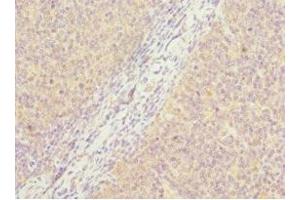 Immunohistochemistry of paraffin-embedded human tonsil tissue using ABIN7162885 at dilution of 1:100 (PCM1 anticorps  (AA 1-260))