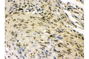 Anti- ELAVL4 Picoband antibody, IHC(P) IHC(P): Human Meningeoma Tissue