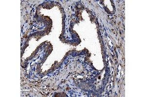 IHC analysis of Liver Carboxylesterase 1/CES1 using anti-Liver Carboxylesterase 1/CES1 antibody (ABIN7602719). (CES1 anticorps  (AA 99-206))
